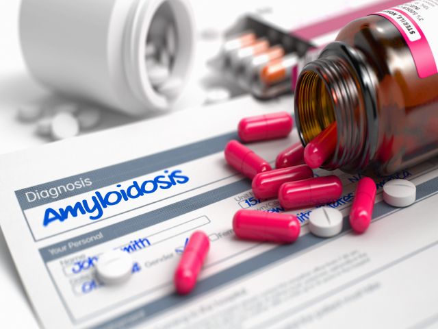 Diagnose Amyloidose: Medikamentenflasche, Tabletten und Behandlungsplan.